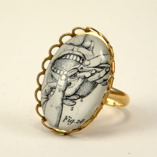Pulling Teeth Engraving from 19th Century Dental Engraving Petite Ring ...